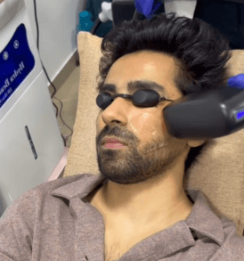 Permanent Beard Shaping