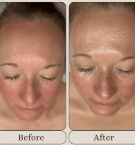 Korean Facial