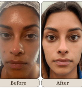 Korean Facial