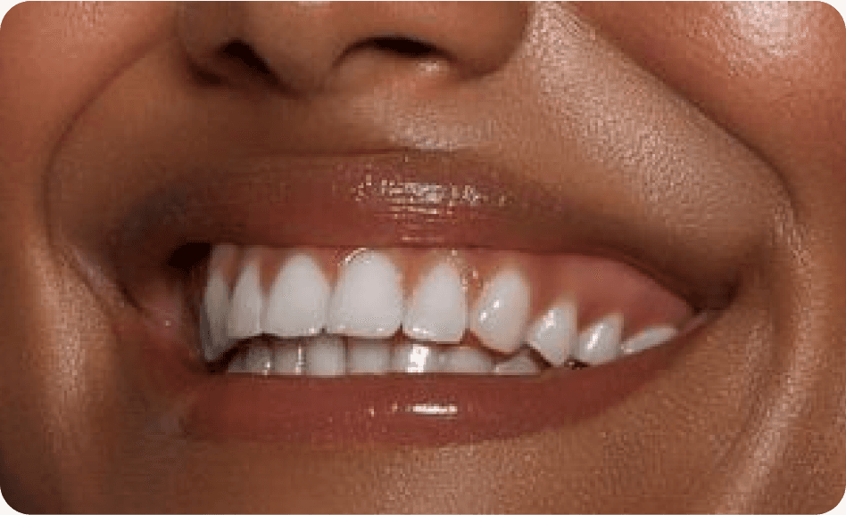 Smile Girl Banner