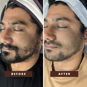 Smile Transformation 10