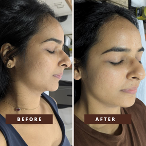 Smile Transformation 12