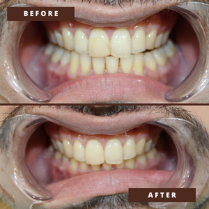 Smile Transformation 13