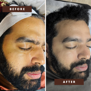 Smile Transformation 15