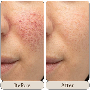 Smile Transformation 16