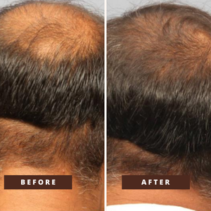 Smile Transformation 3