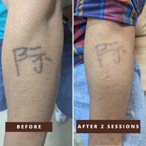 Smile Transformation 6