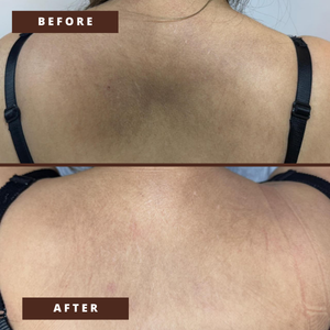 Smile Transformation 7