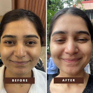 Smile Transformation 9