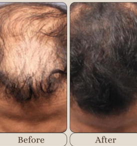 HairCocktail process