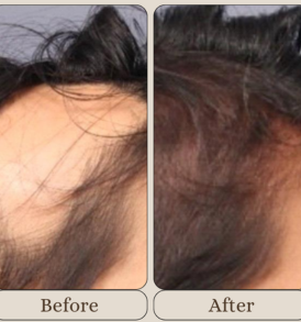 Benefits of HairCocktail